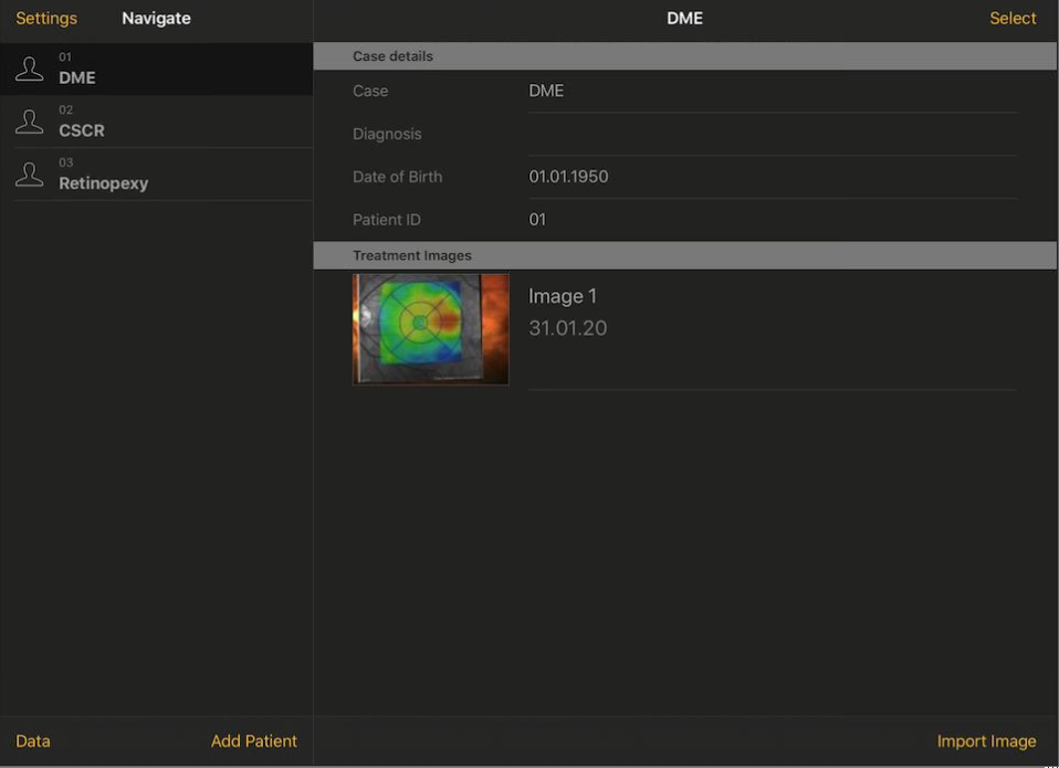 Navigate app for retinal laser with demo cases