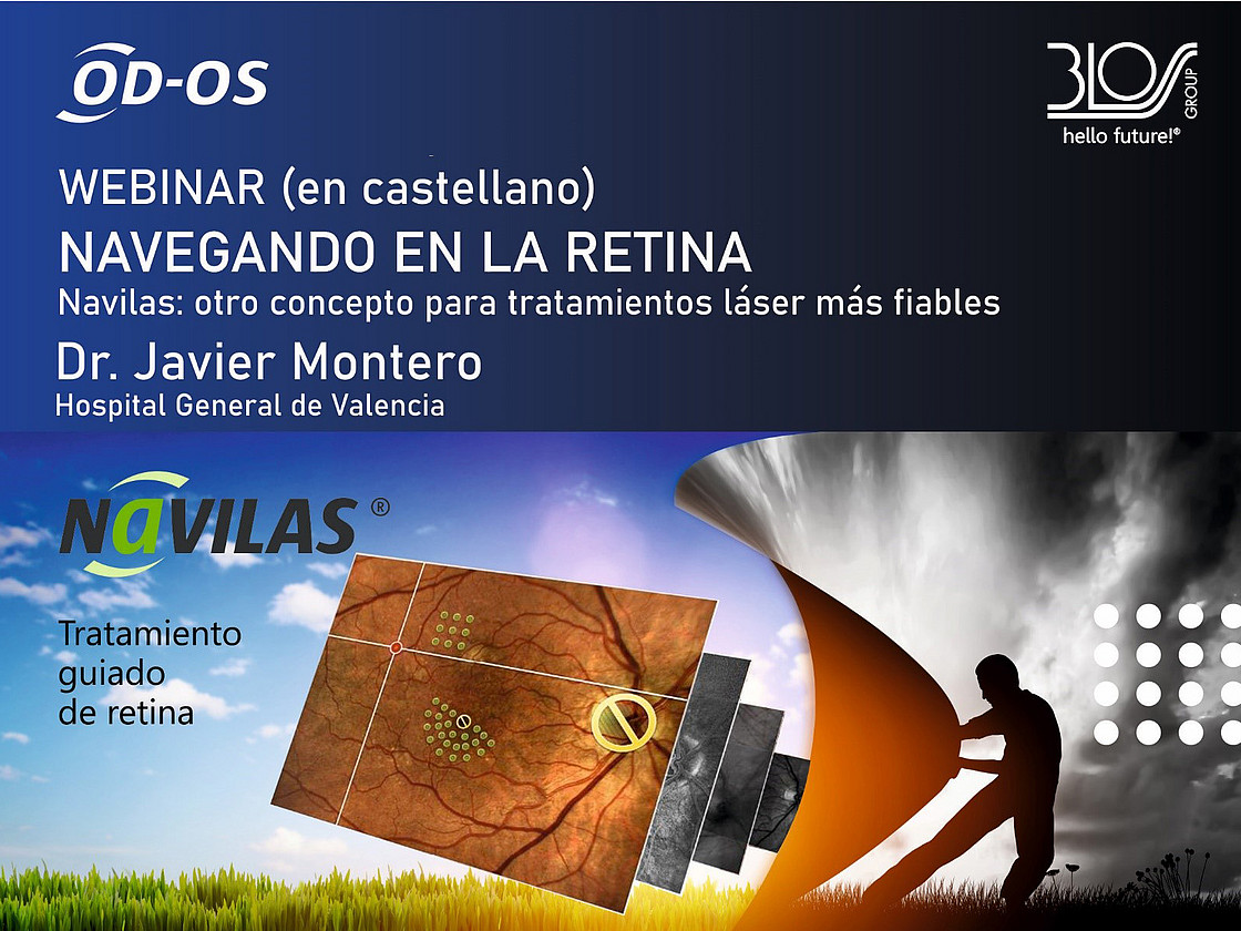 Webinar navegando en la retina