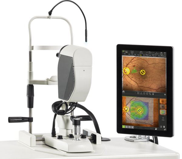 Navilas® 577s retina laser Navilas system for navigated focal laser treatments